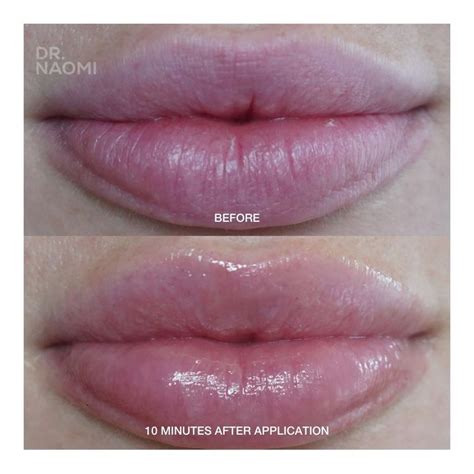 Dr Naomi Apocalips Lip Plumping Treatment review. .